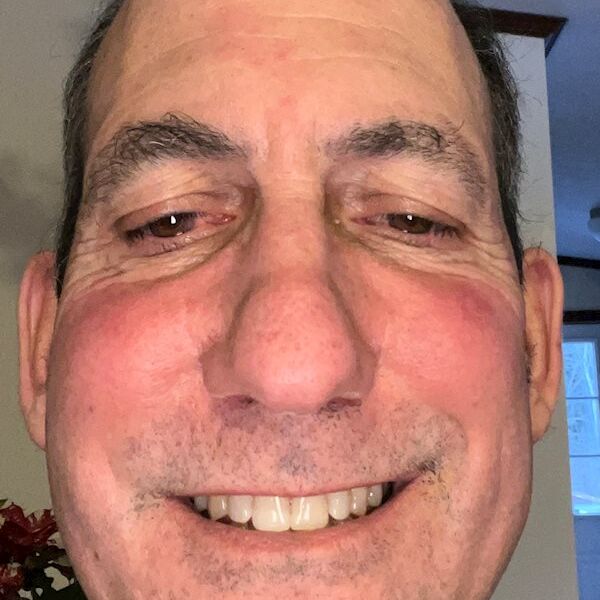 JERRY