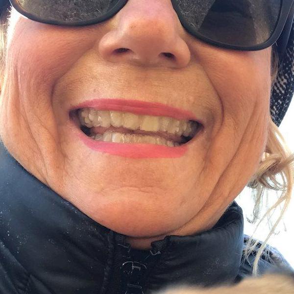 JANIS